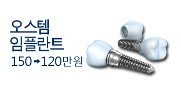 오스템 임플란트 150(X) -> 120(O) 분납가능